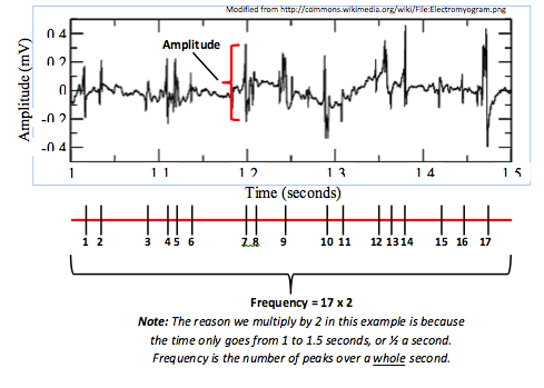 Amplitude