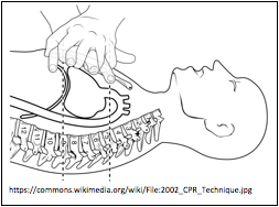 hand only CPR