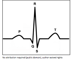 heart waves